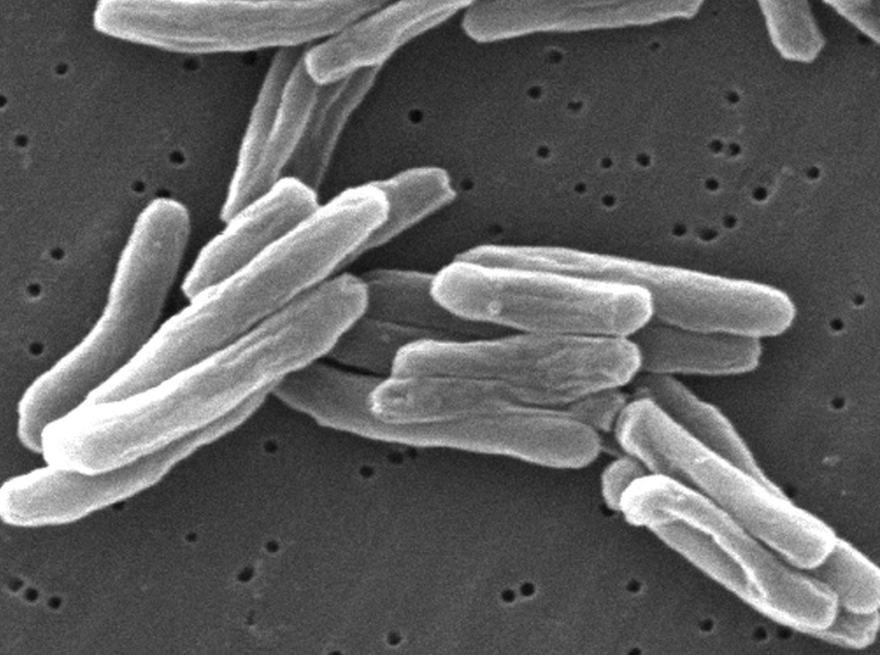     Mycobacterium tuberculosis under an electron microscope
