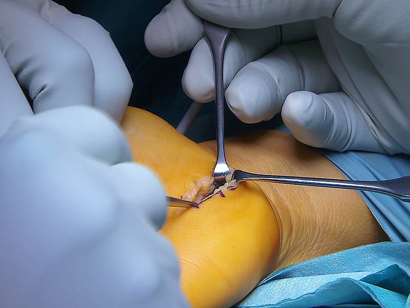 Operation Arzt Chirurg Krankenhaus LKH